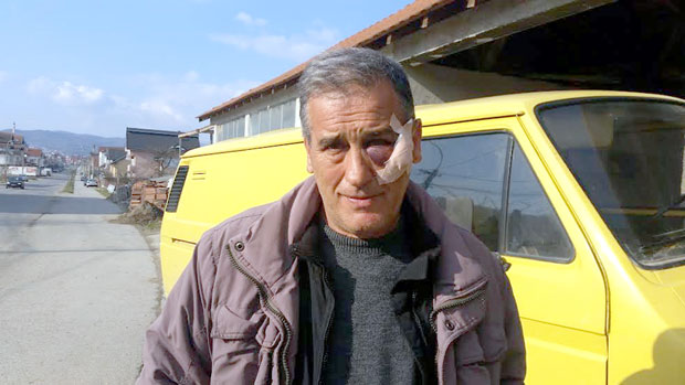 Албанци тукли Негована Станојевића